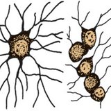 Глиальные клетки